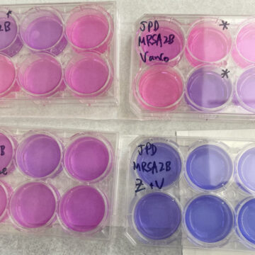 Bye-bye bacteria: Research squashes superbugs