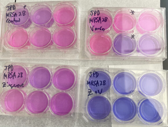 Bye-bye bacteria: Research squashes superbugs